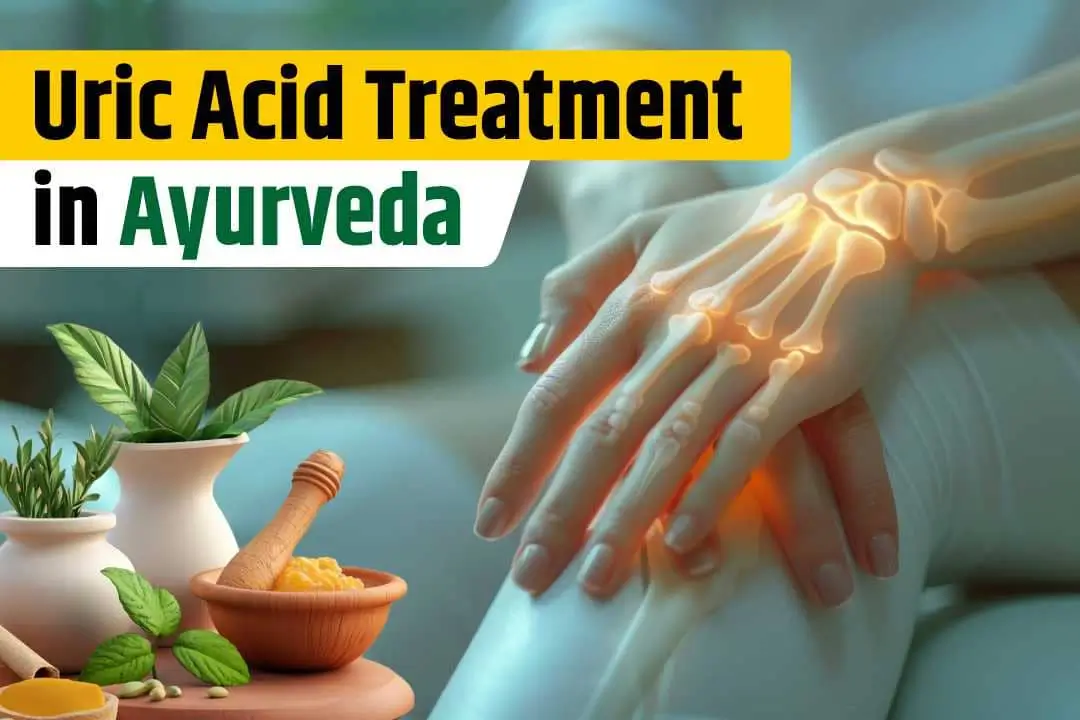 Uric Acid Treatment in Ayurveda